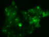 Thumbnail for dataset Fig3b_inclusion_PD_1