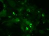 Thumbnail for dataset Fig3b_inclusion_PD_7