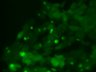 Thumbnail for dataset Fig3b_inclusion_PD_8