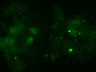 Thumbnail for dataset Fig3b_inclusion_DLB_1