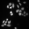 Thumbnail for dataset Figure2A_20211021_EpacSensor_FSKandIBMX_2nd_Dish5