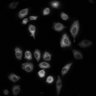 Thumbnail for dataset Figure2C_20211008_EGF_04