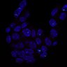 Thumbnail for dataset Fig1j_Pgk1_2