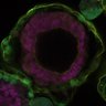Thumbnail for dataset Fig4e_bilaminoid_with-nTB