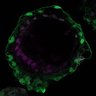 Thumbnail for dataset ExtFig10b_bilaminoid