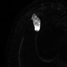 Thumbnail for dataset Fig1b_MT_Norm3