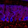 Thumbnail for dataset Fig1M_WT1_Lobule1_2