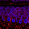 Thumbnail for dataset Fig1M_WT1_Lobule3_1