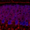 Thumbnail for dataset Fig1M_WT1_Lobule3_2