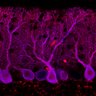 Thumbnail for dataset Fig1M_WT1_Lobule9_1