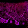 Thumbnail for dataset Fig1M_WT1_Lobule9_2