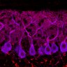 Thumbnail for dataset Fig1M_WT1_Lobule9_3