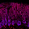 Thumbnail for dataset Fig1M_WT1_Lobule9_4
