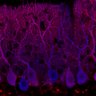 Thumbnail for dataset Fig1M_WT2_Lobule1_2