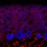 Thumbnail for dataset Fig1M_WT2_Lobule3_1