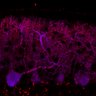 Thumbnail for dataset Fig1M_WT2_Lobule9_2