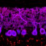 Thumbnail for dataset Fig1M_WT2_Lobule9_3