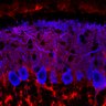 Thumbnail for dataset Fig1M_WT3_Lobule1_1