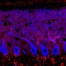 Thumbnail for dataset Fig1M_WT3_Lobule1_2