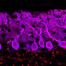 Thumbnail for dataset Fig1M_WT3_Lobule9_1