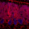 Thumbnail for dataset Fig1M_KO1_Lobule3_1