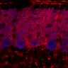 Thumbnail for dataset Fig1M_KO1_Lobule3_2