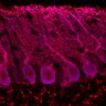Thumbnail for dataset Fig1M_KO1_Lobule9_1