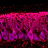 Thumbnail for dataset Fig1M_KO1_Lobule9_3