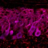 Thumbnail for dataset Fig1M_KO1_Lobule9_4