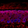 Thumbnail for dataset Fig1M_KO2_Lobule1_1