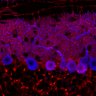 Thumbnail for dataset Fig1M_KO2_Lobule1_2