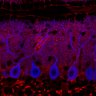 Thumbnail for dataset Fig1M_KO2_Lobule3_1