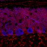 Thumbnail for dataset Fig1M_KO2_Lobule3_2