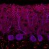 Thumbnail for dataset Fig1M_KO2_Lobule9_1