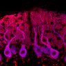 Thumbnail for dataset Fig1M_KO2_Lobule9_3