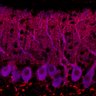 Thumbnail for dataset Fig1M_KO2_Lobule9_4