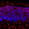 Thumbnail for dataset Fig1M_KO3_Lobule1_1
