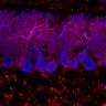 Thumbnail for dataset Fig1M_KO3_Lobule1_2