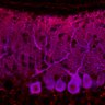 Thumbnail for dataset Fig1M_KO3_Lobule9_1