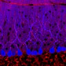 Thumbnail for dataset Fig1O_WT1_Lobule3_1