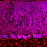 Thumbnail for dataset Fig1O_WT1_Lobule9_2