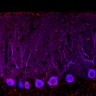 Thumbnail for dataset Fig1O_WT1_Lobule9_3