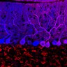 Thumbnail for dataset Fig1O_WT1_Lobule9_4