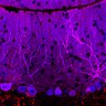 Thumbnail for dataset Fig1O_WT2_Lobule9_1