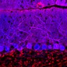 Thumbnail for dataset Fig1O_WT2_Lobule9_4
