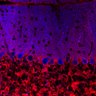 Thumbnail for dataset Fig1O_KO1_Lobule3_1