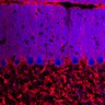 Thumbnail for dataset Fig1O_KO1_Lobule3_2