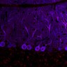 Thumbnail for dataset Fig1O_KO1_Lobule9_1