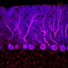 Thumbnail for dataset Fig1O_KO1_Lobule9_2