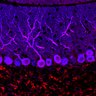 Thumbnail for dataset Fig1O_KO1_Lobule9_3